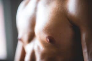 Adult Gynecomastia Surgery Houston