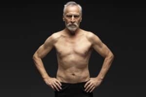 Senior Gynecomastia Surgery Houston